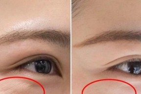 拥有年轻肌肤的秘诀——有效去除鱼尾纹和皱纹（抛开岁月痕迹）