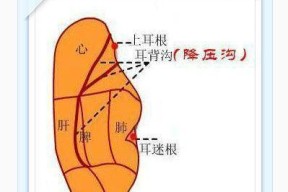 蓝牙耳机小号耳帽适合哪种耳道？