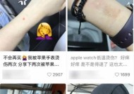苹果手表链断了怎么修？修理过程中需要注意什么？