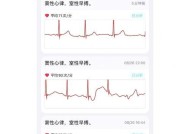 苹果手机测脉搏功能如何使用？