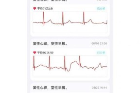 苹果手机测脉搏功能如何使用？