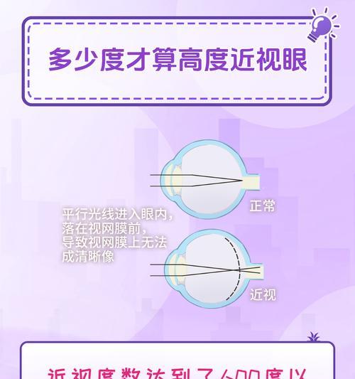 高度近视者如何正确佩戴视频眼镜？  第3张