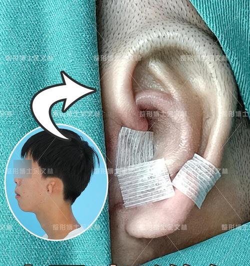 金属手机壳畸形怎么办？如何修复或更换？  第3张