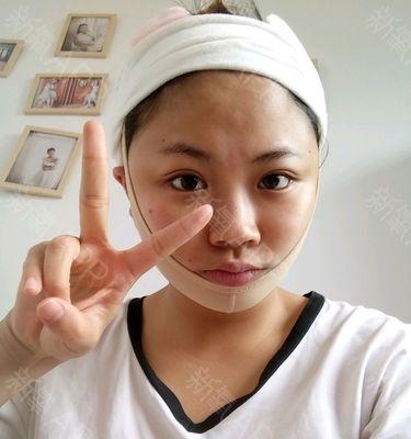 充电器头套太紧无法插入怎么办？解决方法是什么？  第3张