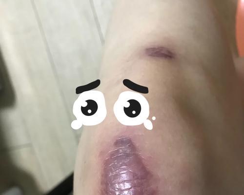 电瓶车碾过物体后会有什么后果？如何避免损坏？  第3张