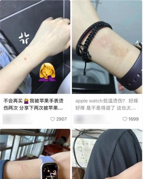 苹果手表链断了怎么修？修理过程中需要注意什么？  第1张