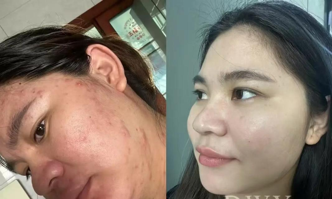 轻颜相机拍出斑驳脸的原因是什么？如何改善效果？  第2张