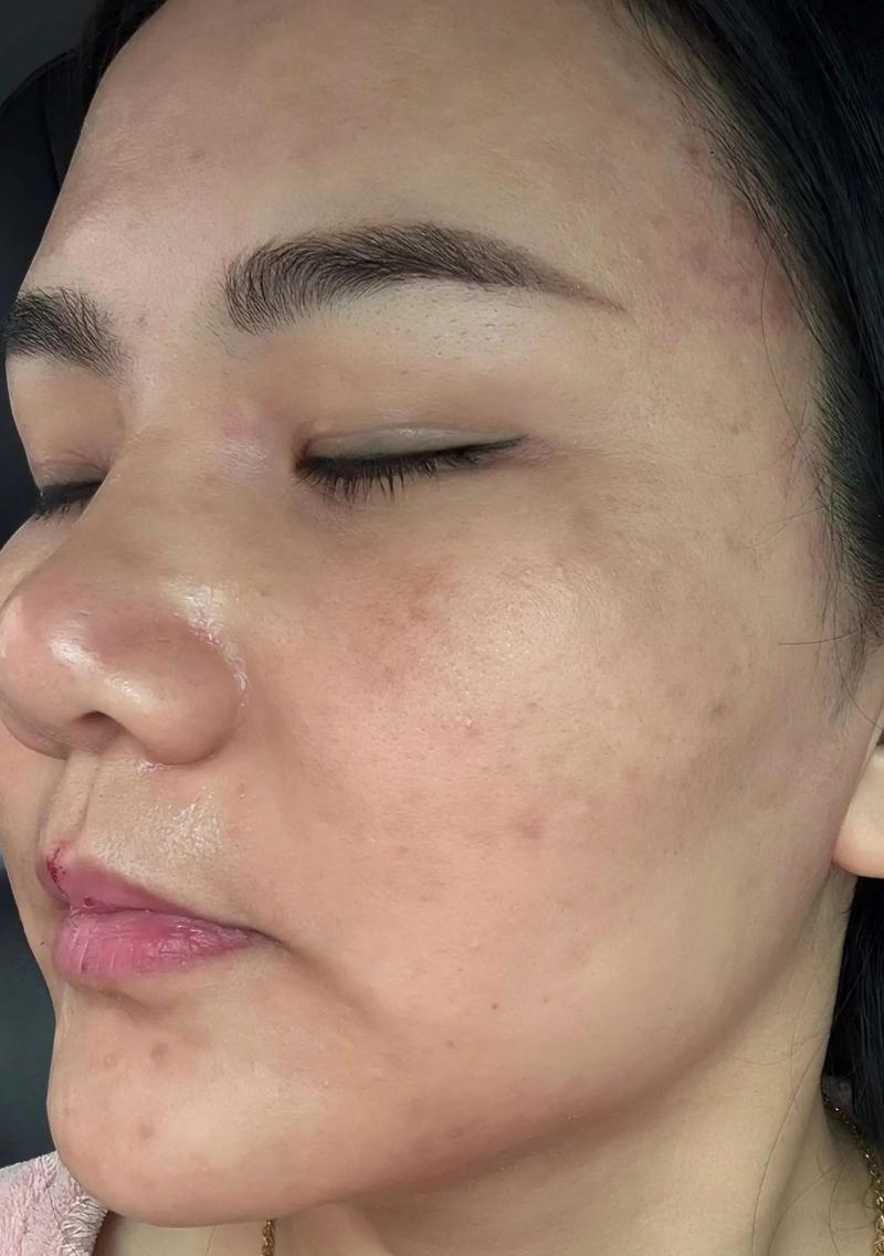 轻颜相机拍出斑驳脸的原因是什么？如何改善效果？  第3张